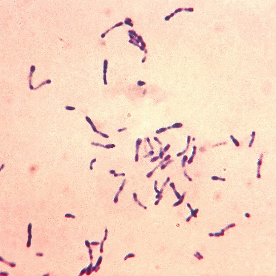  bakterie Gram-dodatnie Corynebacterium diphtheriae 