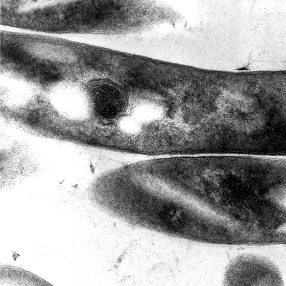 Mikrofotografia mikroskopowa TEM bakterii Mycobacterium tuberculosis