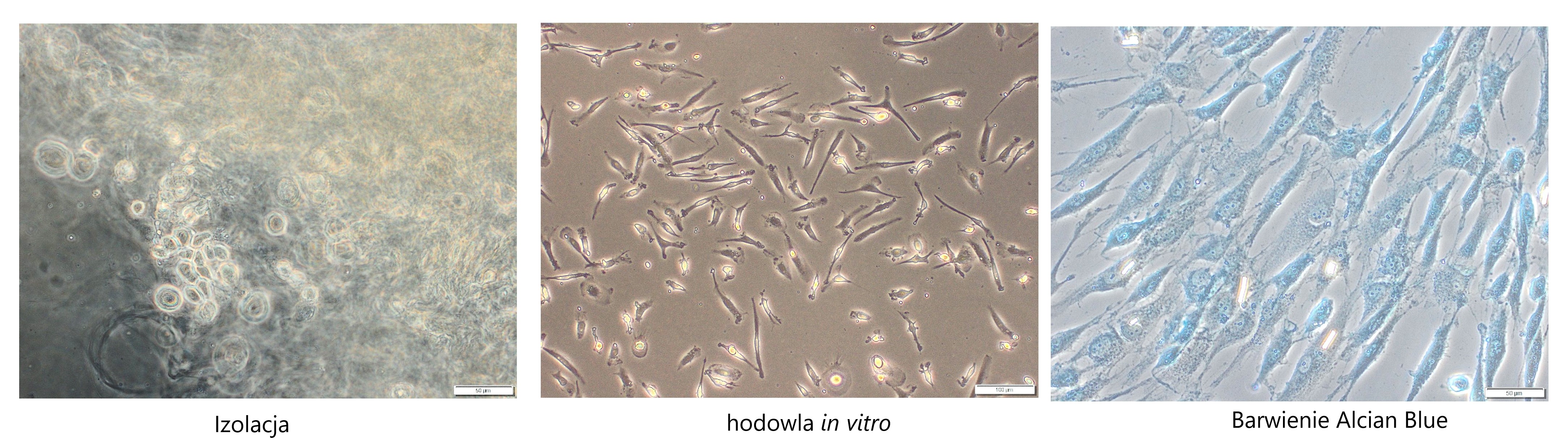 komórki chondrocyty w trakcie izolacji z tkanki chrzęstnej, hodowli in vitro oraz potwierdzenie fenotypu barwieniem alician blue