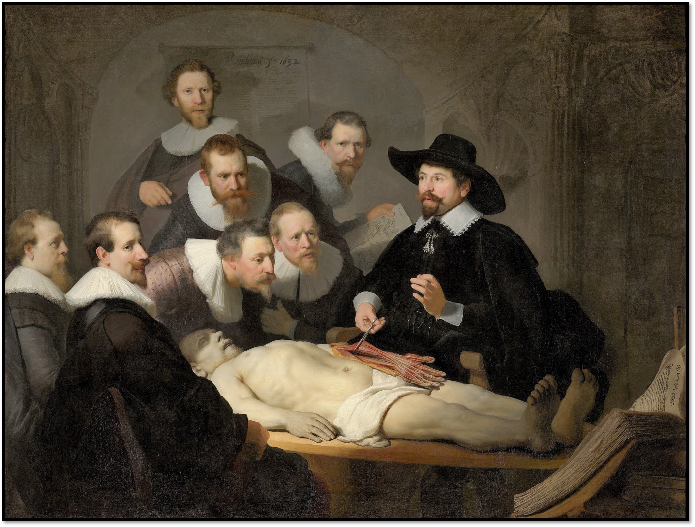 Rembrandt „Lekcja anatomii doktora Tulpa”