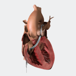 Impella RP.png