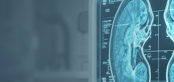 nerki a kontrast kwadrat bez tekstu.png