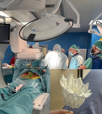 innowacyjny zabieg 10_2025.jpg